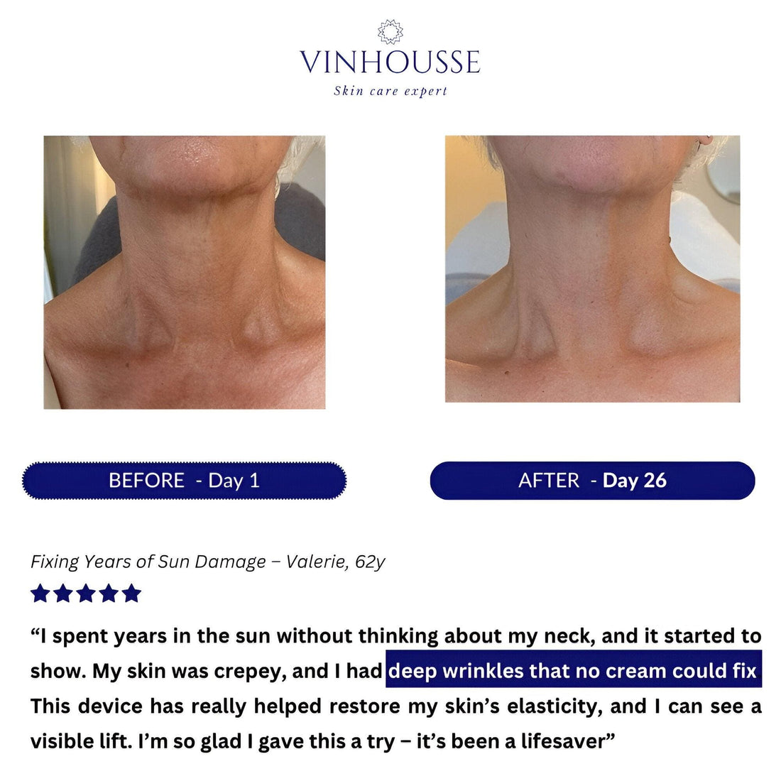 7-in-1 LED Neck Lifter™