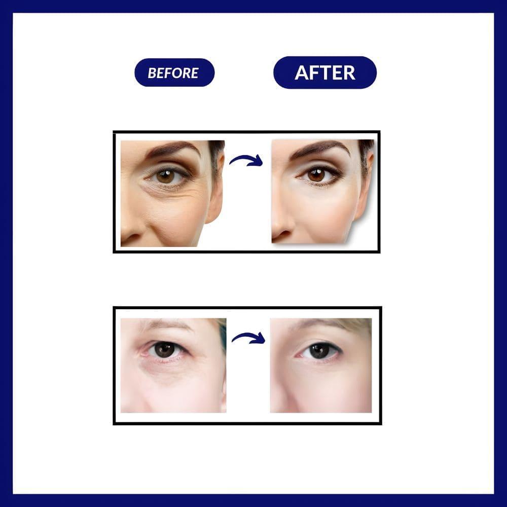 LED Eye Massager™ Deluxe - Vinhousse