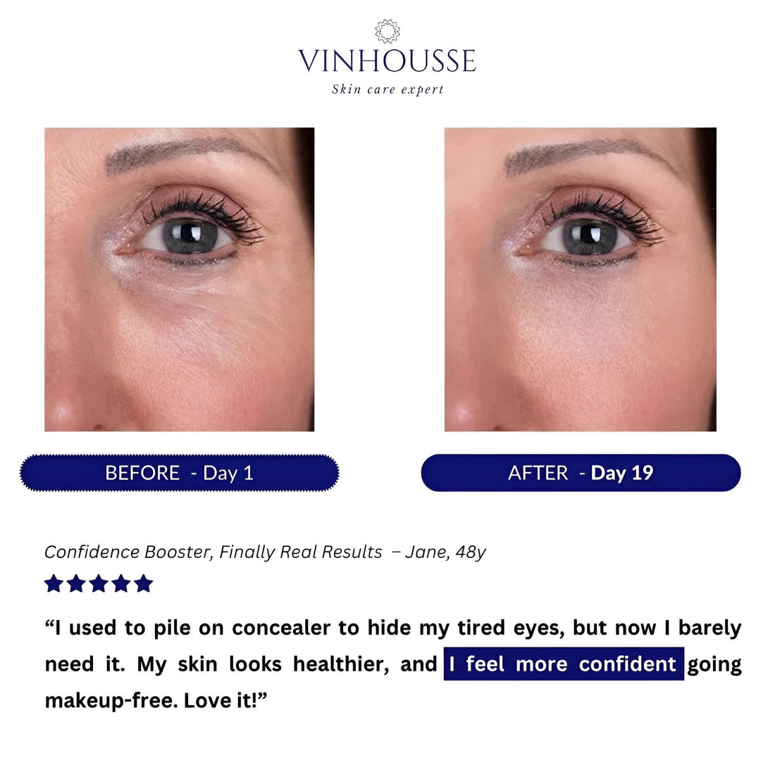 Eye Renew™ Deluxe
