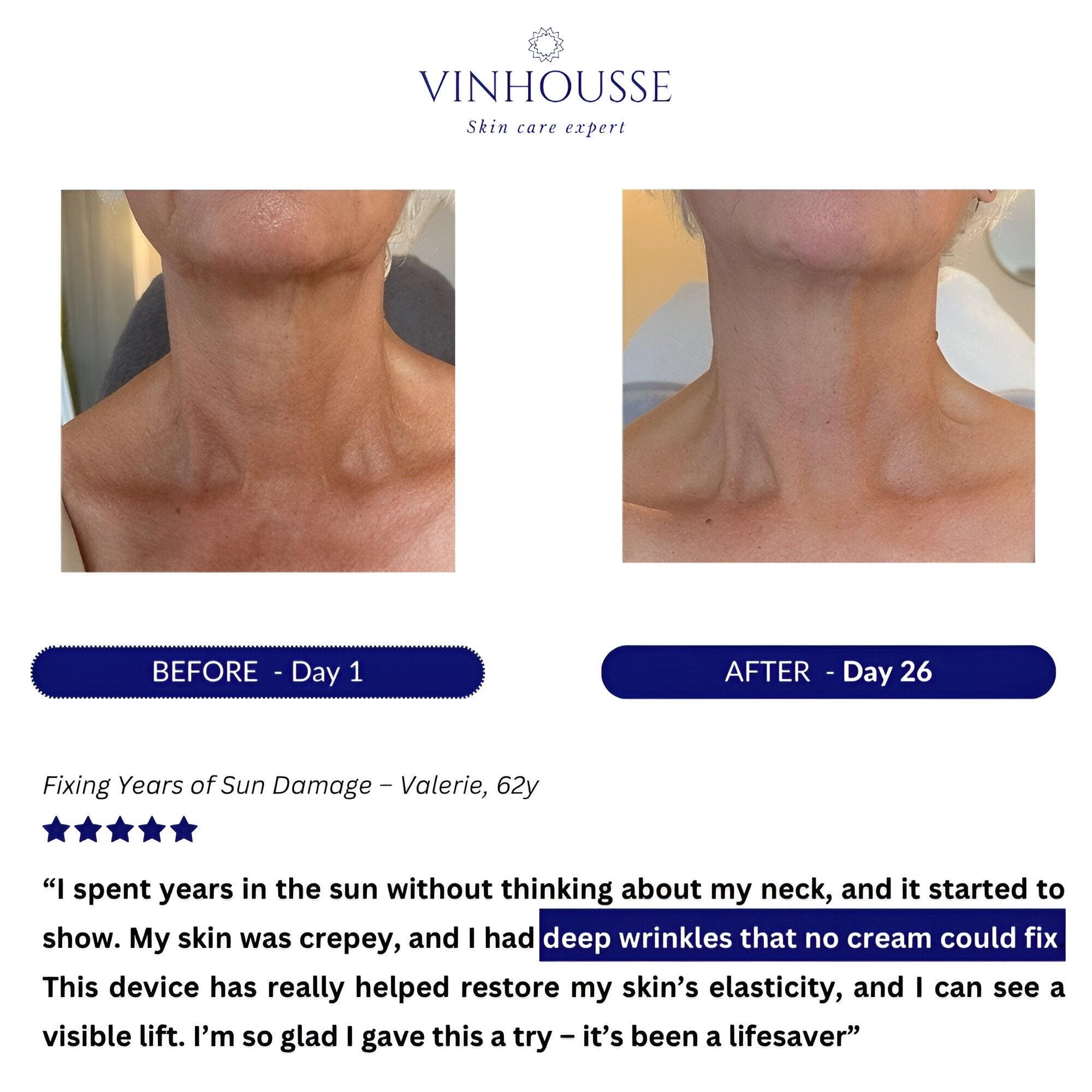 7-in-1 LED Neck Lifter™