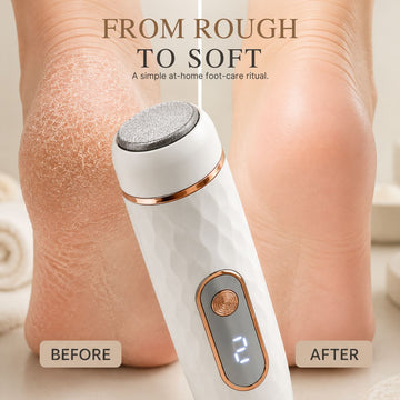 Foot File – Callus Remover